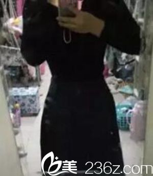 分享我在沈阳茗湲做腰腹吸脂手术后3个月恢复全过程