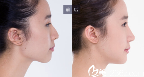 广州美莱<!--<i data=20240703-sp></i>--><span style= 广州美莱<!--<i data=20240703-sp></i>--><span style=