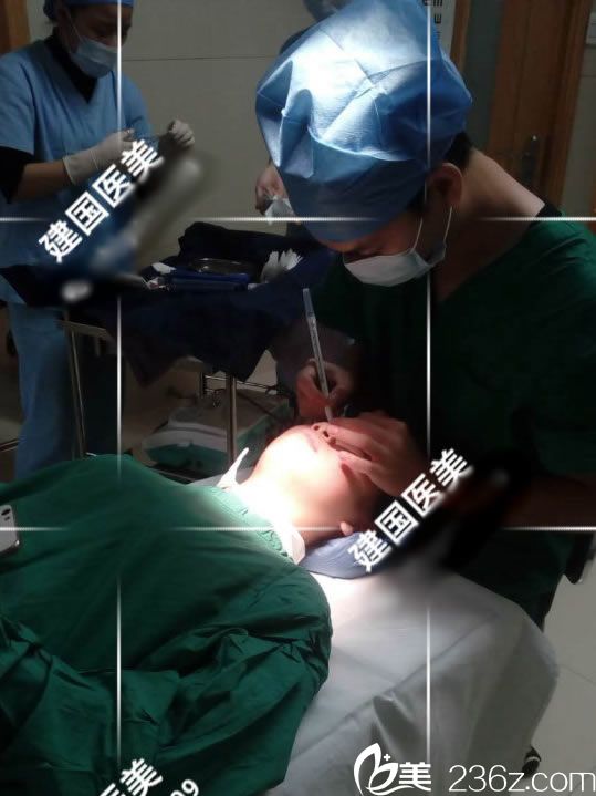 徐林杰医生做双眼皮手术过程