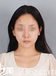 术前样貌 术前样貌