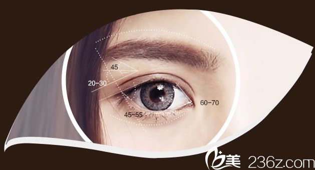 宁波壹加壹双眼皮手术