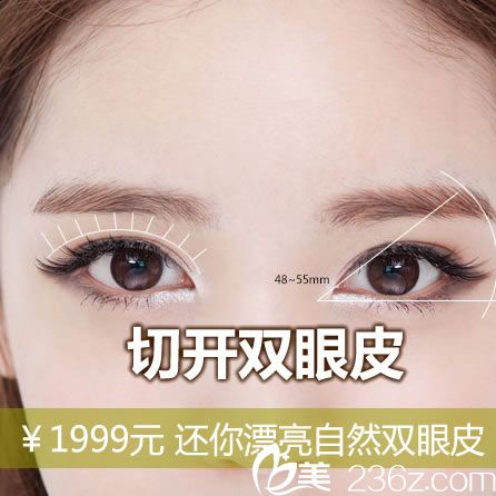 宁波壹加壹割双眼皮优惠活动 1999元起郭院长让你3天变大眼