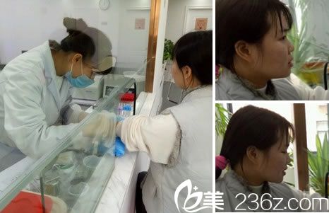 做鼻综合手术前的常规检查 做鼻综合手术前的常规检查