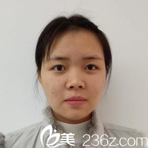 金华瑞丽门诊部刘政术前照片1