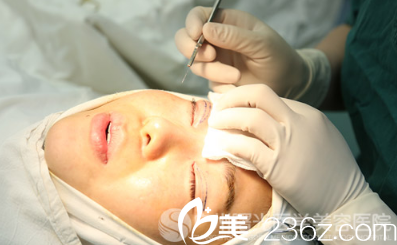 广州曙光范丹医生双眼皮手术过程图