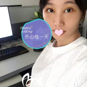 双眼皮第三天工作照 双眼皮第三天工作照