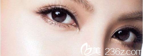 韩国清潭高端私人定制双眼皮