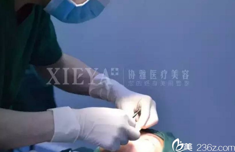 长沙协雅双眼皮真人案例