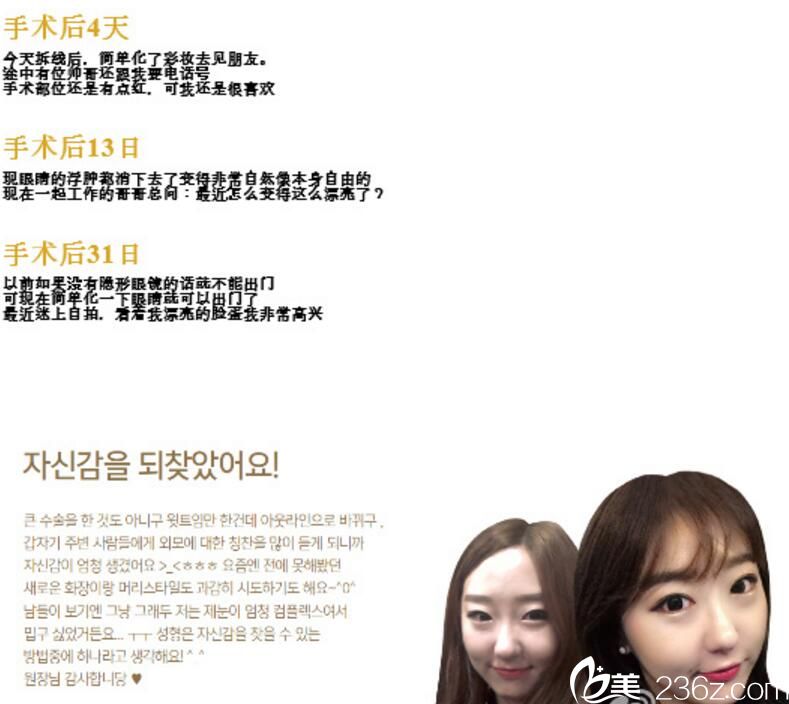 韩国Parkview整形外科医院郑然周院长做双眼皮怎么样 真人案例对比