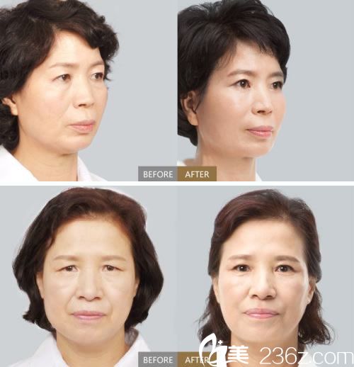 <span style= <span style=