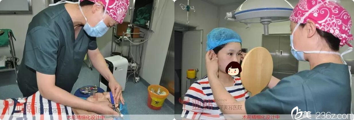 双眼皮术前划线设计 双眼皮术前划线设计