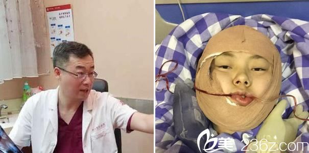 下颌角手术完成当天照片 下颌角手术完成当天照片