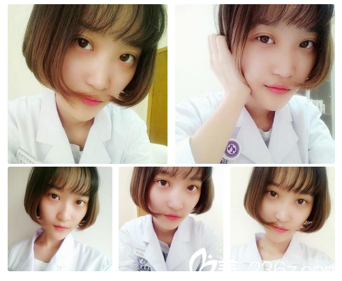 广州艺美张涛全切双眼皮案例15天自拍