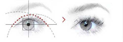 韩国艺德雅整形外科眼部整形示意图 韩国艺德雅整形外科眼部整形示意图