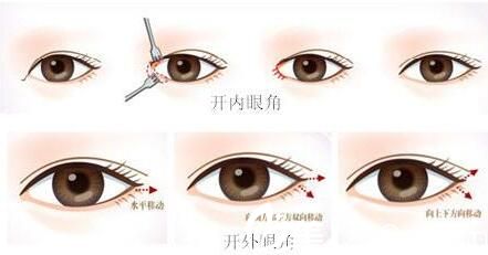 韩国VIEW必妩整形医院金正敏 韩国VIEW必妩整形医院金正敏