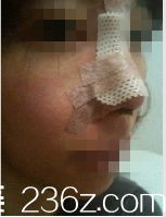 韩国艺德雅整形外科案例 韩国艺德雅整形外科案例