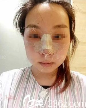 在大连新华美天做隆鼻手术当天.jpg