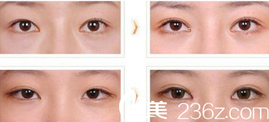 徐在敦整形外科案例 徐在敦整形外科案例