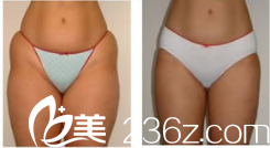 徐在敦整形外科案例 徐在敦整形外科案例