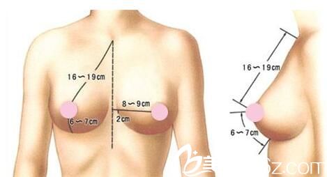 韩国iWell爱我整形外科医院正双平面隆胸 韩国iWell爱我整形外科医院正双平面隆胸