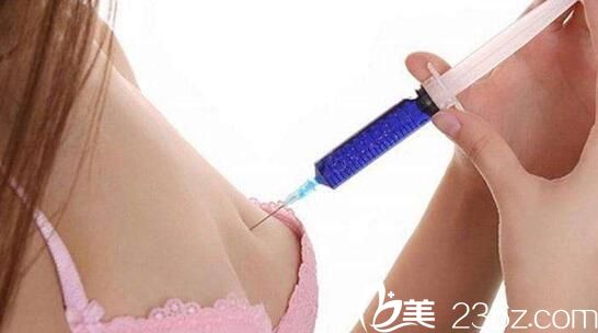 韩国iWell爱我整形外科医院小针隆胸