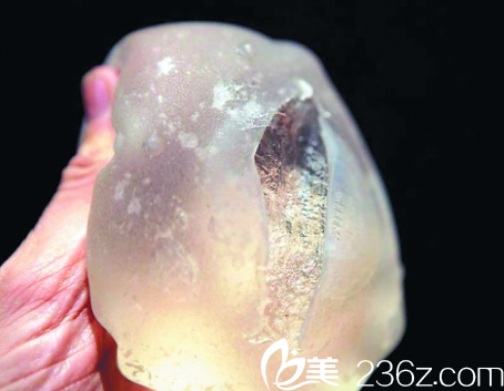 韩国在敦整形外科隆胸假体 韩国在敦整形外科隆胸假体