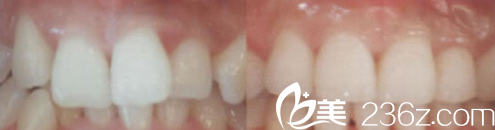 韩国face-line整形医院 韩国face-line整形医院