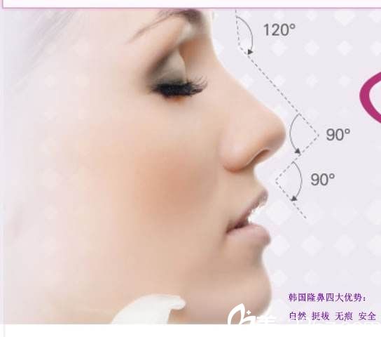 韩国iWell爱我整形外科医院韩式隆鼻