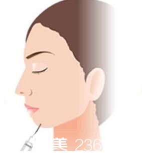 韩国iWell爱我整形外科医院麻醉