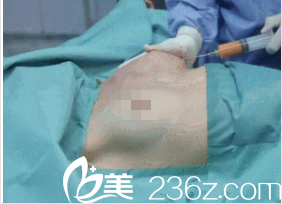 韩国在敦整形外科案例