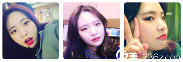 术前照片 术前照片