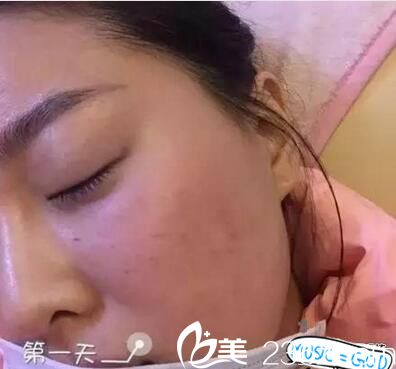 南阳艾美水光注射天 南阳艾美水光注射天