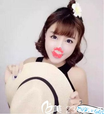 南阳艾美水光注射术后效果 南阳艾美水光注射术后效果