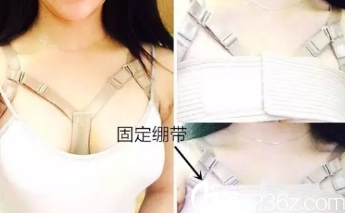 韩国jk整形外科医院做隆胸手术真人案例2 韩国jk整形外科医院做隆胸手术真人案例2