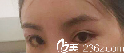 韩国MIGO整形外科医院案例 韩国MIGO整形外科医院案例