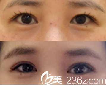 韩国MVP整形医院案例 韩国MVP整形医院案例