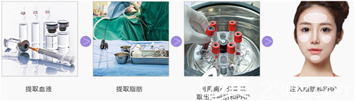 韩国贝缇莱茵整形医院俞昡在医生