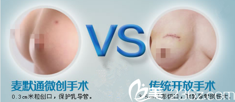 韩国MD胸部整形医院宣传图