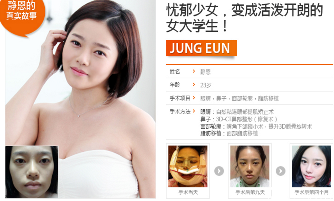 韩国博朗温整形外科做鼻子、轮廓好吗？ 