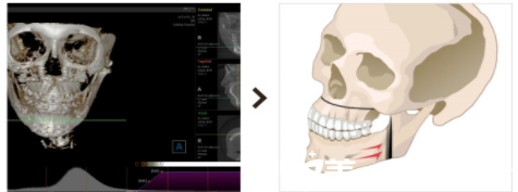 20171222_1513913012449259.png blob.png