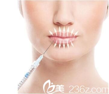 韩国RUBY如妃整形外科医院丰唇术 韩国RUBY如妃整形外科医院丰唇术