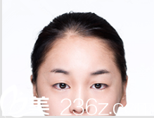 韩国DREAM梦想整形外科医院案例 韩国DREAM梦想整形外科医院案例