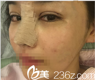 韩国DREAM梦想整形外科医院案例 韩国DREAM梦想整形外科医院案例