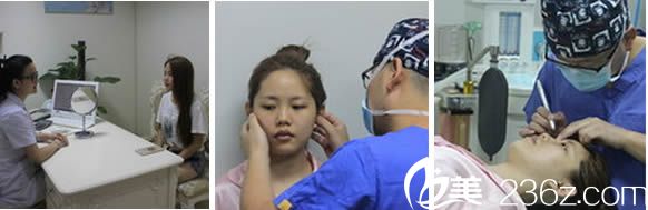 袁纯新隆鼻整形前面诊