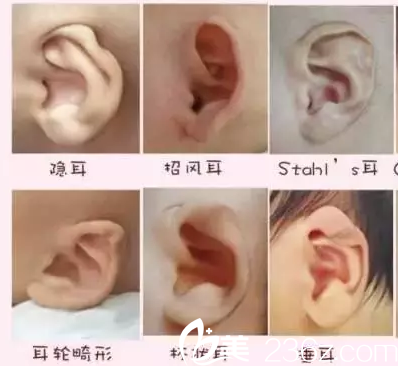 各种不同的耳部情况