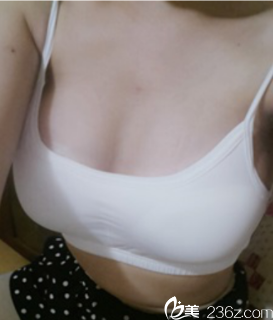 HERSHE整形外科医院隆胸 HERSHE整形外科医院隆胸