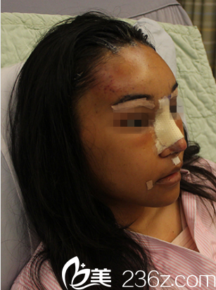 韩国DREAM梦想整形外科医院案例 韩国DREAM梦想整形外科医院案例