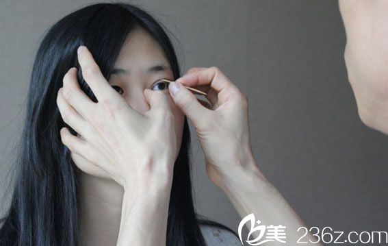 院长亲自设计双眼皮方案 院长亲自设计双眼皮方案