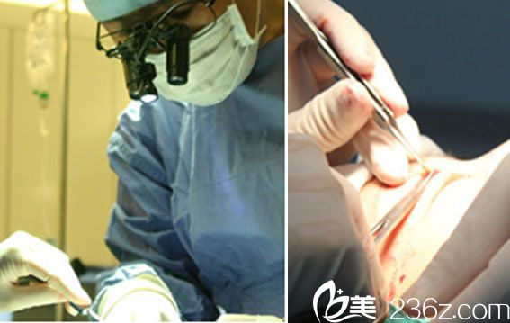 显微镜下操作双眼皮手术 显微镜下操作双眼皮手术