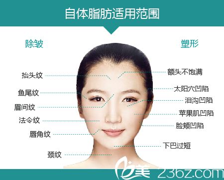 自体脂肪填充的范围